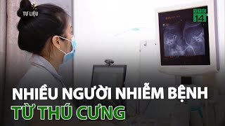 Nhiều người nhiễm bệnh từ thú cưng | VTC14