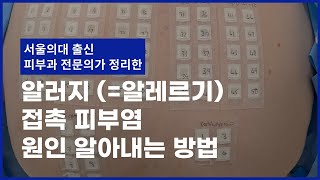 '알러지 접촉 피부염' 원인은 이렇게 찾아보세요