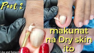 Vlog 575|Dry Skin/Ingrown Removal| PEDICURE 475