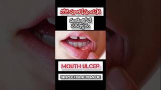 ఇన్నాళ్లు ఇది తెలియక ఎంత ఇబ్బంది పడ్డామో#mouthulcer #homeremedy #amazing #simple#easy#tips#heathtips