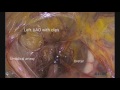 laparoscopic anatomy