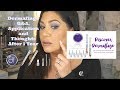 Dermaflage Q&A w/ Liquid Foundation Application-For Ice Pick Acne Scars