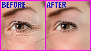 இப்படி பண்ணுனா 10 வயசு குறைத்த மாதிரி தெரிவீங்க | anti aging home remedies in tamil | wrinkle |