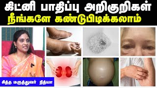 கிட்னி பாதிப்பு அறிகுறிகள் | Kidney failure symptoms in tamil | Dr Nithya Siddha | Doctor Interview