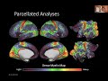 ohbm 2022 200 symposium matthew f glasser the hcp style approach to brain imaging and imag…