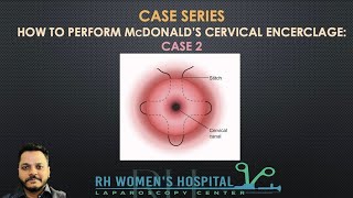 #198 : CASE SERIES : HOW TO PERFORM MCDONALDS CERVICAL ENCERCLAGE: CASE 2