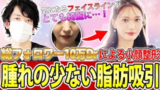 【顎下・頬下脂肪吸引/ジョールファット】腫れの少ない小顔整形・脂肪吸引【メーラーファット】