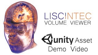 Volume Viewer available at the Unity Asset Store