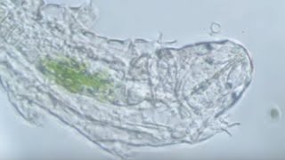 Waterbear | A Documentary about Tardigrades