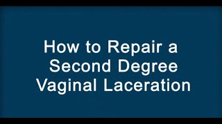 How to Repair a Vaginal Laceration | Merck Manual Professional Version