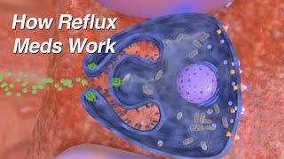 How do Reflux Medications Work (Proton Pump Inhibitors, H2 Blockers, Alginates)