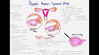 Polycystic Ovarian Syndrome (PCOS) - clinics, diagnosis, treatment, differentials