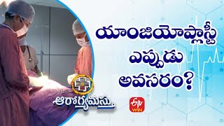 Angioplasty | యాంజియోప్లాస్టీ ఎప్పుడు అవసరం? | Aarogyamastu | 1st January 2022