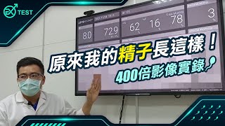 【EX TEST】醫檢師告訴你什麼是AI影像精子分析 - 你看過自己的精子長什麼樣子嗎?