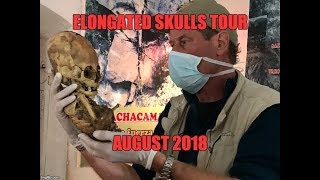 Elongated Skull Tour Of Peru: August 2018