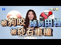 大傷口一定比小傷口縫的針多嗎？ to be or not to be（ 健康二選一｜ep81）