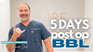 Embracing Progress: 5 Days Post-Op After a BBL