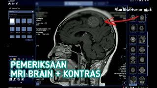 Pemeriksaan MRI Brain + Kontras | Klinis Lesi Intracerebral Metastase Ca Mammae