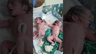 Twins baby after birth #cute #cutebaby