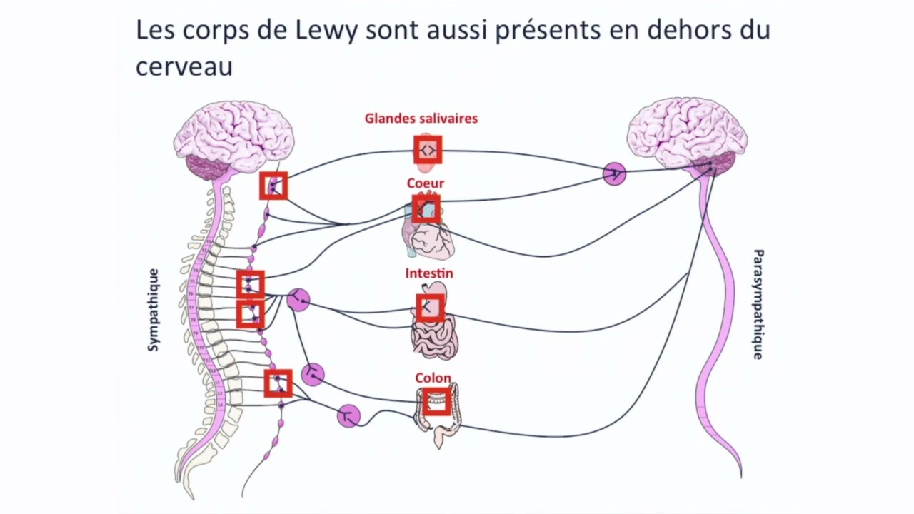 S5E5 La Maladie De Parkinson Débute T-elle Dans Les Intestins? (Pr ...