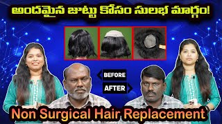 అందమైన జుట్టు కోసం సులభ మార్గం|| hair patch fixing for men || hair patch for men|| hair replacement