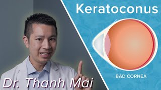 Symptoms and Treatments of Keratoconus With Dr. Thanh Mai