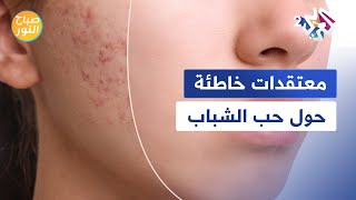 7 معتقدات خاطئة حول حب الشباب