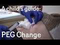 A child's guide to hospital: PEG Change