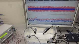 樹脂容器を利用した、超音波プローブの発振制御実験－－共振現象と非線形現象の最適化技術－－（超音波システム研究所）