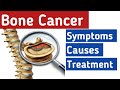 Cancer in bones - Stages, Causes, Diagnosis Bone cancer symptoms, Bone cancer treatment