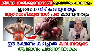 മൂത്രമൊഴിക്കുമ്പോൾ പത ഉണ്ടാവാറുണ്ടോ |കാലിലും മുഖത്തും ഇത്തരം മാറ്റങ്ങളും കാണാറുണ്ടോ | kidney failure