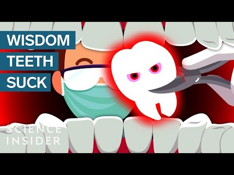 Why Do Wisdom Teeth Suck Ejoy English