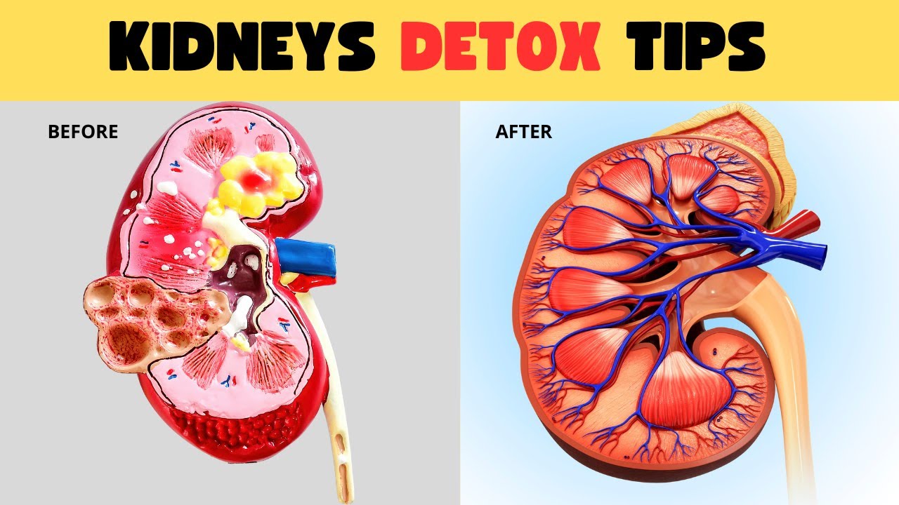 9 Ways To Detox And Cleanse Your Kidneys Naturally - YouTube