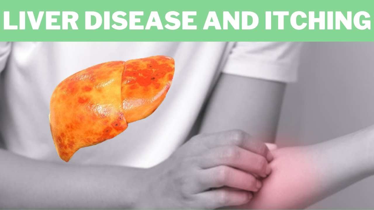 Liver Disease And Itching - Why Do Your Skin Itch When You Have Liver ...