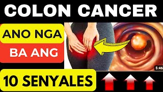 10 Senyales Ng Colon Cancer Na Di Mo Dapat Balewalain | Colon Cancer Warning Signs