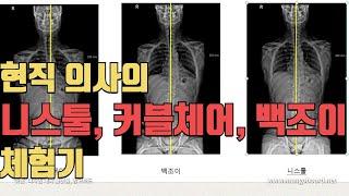 하남 정형외과 커블체어 X 백조이 X 닐링체어 - 도수치료하는 의사의 내돈내산 후기(No 광고!!)