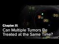 Can Multiple Tumors Be Treated at the Same Time? Chapter 11 — Brain Metastases: A Documentary