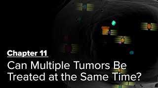 Can Multiple Tumors Be Treated at the Same Time? Chapter 11 — Brain Metastases: A Documentary