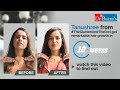 Dr Batra Hair Loss Treatment Reviews | Know how Tanushree had an amazing hair growth in 10 weeks!