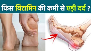 एड़ी में दर्द इस Vitamin Deficiency का Reason, Home Remedy से कैसे ठीक करें | Boldsky