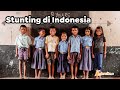 Kupas Tuntas AKM Literasi SMP | Stunting di Indonesia