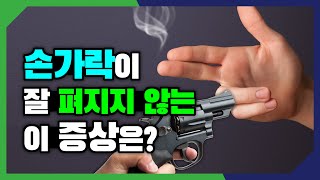 방아쇠 수지- 손가락이 잘 펴지지 않을때