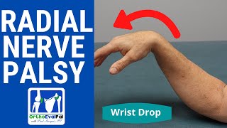 Radial Nerve Palsy (Wrist Drop) Evaluation