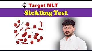 Sickling Test #Sickle_cells #mpgroup5 #labtechnician