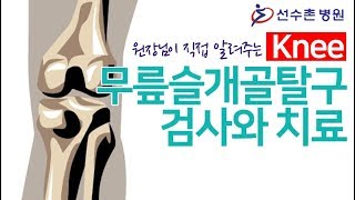 무릎 슬개골탈구 이야기3 - 무릎 슬개골탈구 검사 및 치료