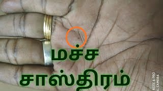 உங்கள் கைகளில் மச்சம் இருக்கிறதா | The Secret Of Moles On Your Body