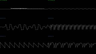 Nemesis/Gradius MSX Soundtrack (PSG + SCC+) - Oscilloscope View