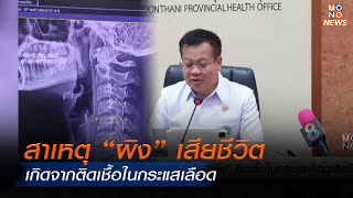 สสจ.อุดรฯ เผย “ผิง” เสียชีวิตติดเชื้อในกระแสเลือด | Mono ข่าวค่ำ | 9 ธ.ค. 67