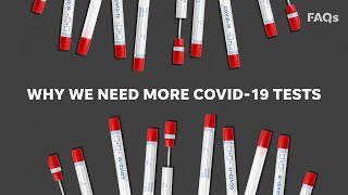 Why widespread COVID-19 testing is crucial to fighting the coronavirus pandemic | Just The FAQs