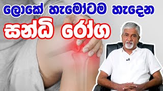 සන්ධි රෝග - Sandi Roga   joint disorders ayurvedic treatment   |  Dr Ashoka Kumara Karunarathna